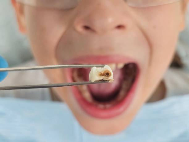 Best Emergency Denture Repair in La Vista, NE